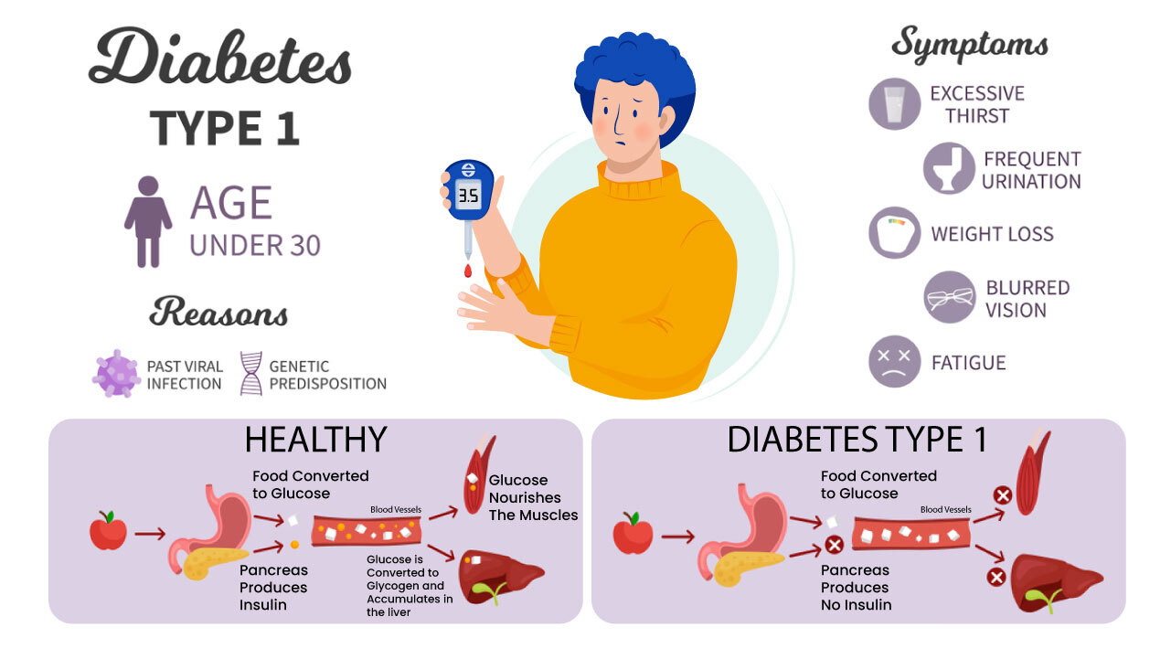 Type 1 Diabetes