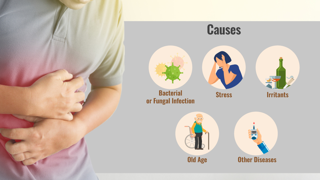 Causes of chronic gastritis