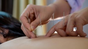 Acupuncture to cure chrons disease