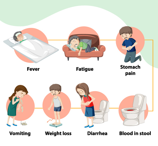 Chrons Disease Symptoms