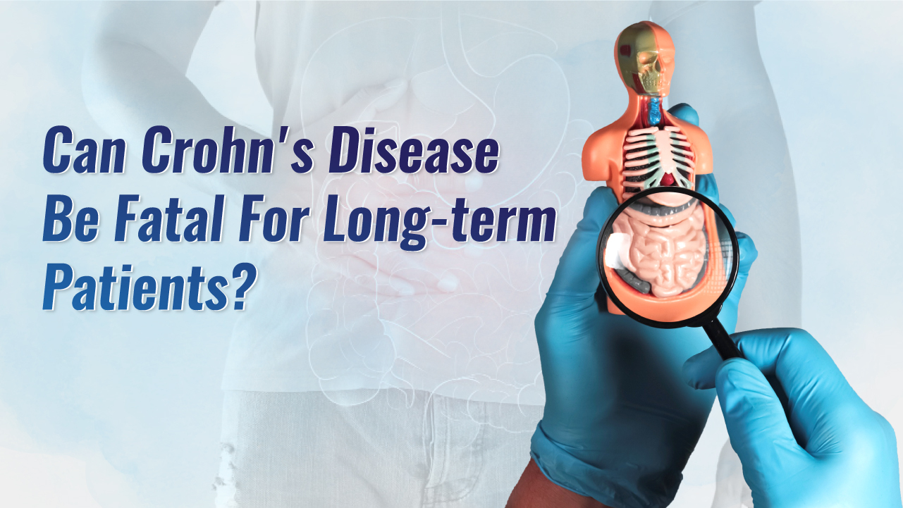 can-Crohn's-disease-be-fatal-for-long-termpatients-1