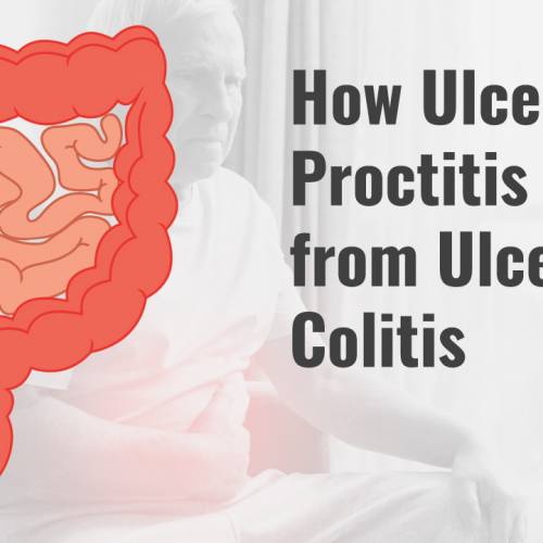 Ulcerative Proctitis vs. Ulcerative Colitis: What Are the Differences?