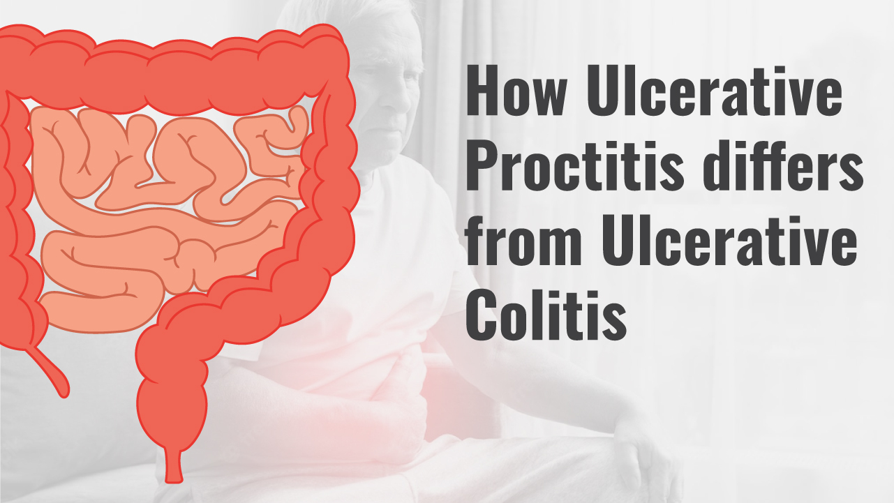 Ulcerative Proctitis vs colitis