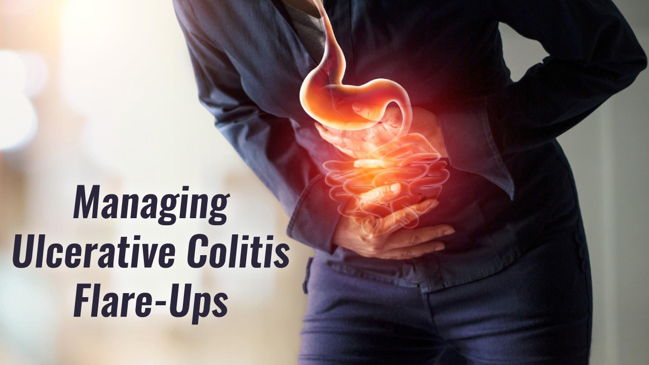 TIPS ON HOW TO MANAGE AN ULCERATIVE COLITIS FLARE UP 3 1